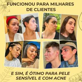 Sabonete Artesanal de Açafrão e Dolomita