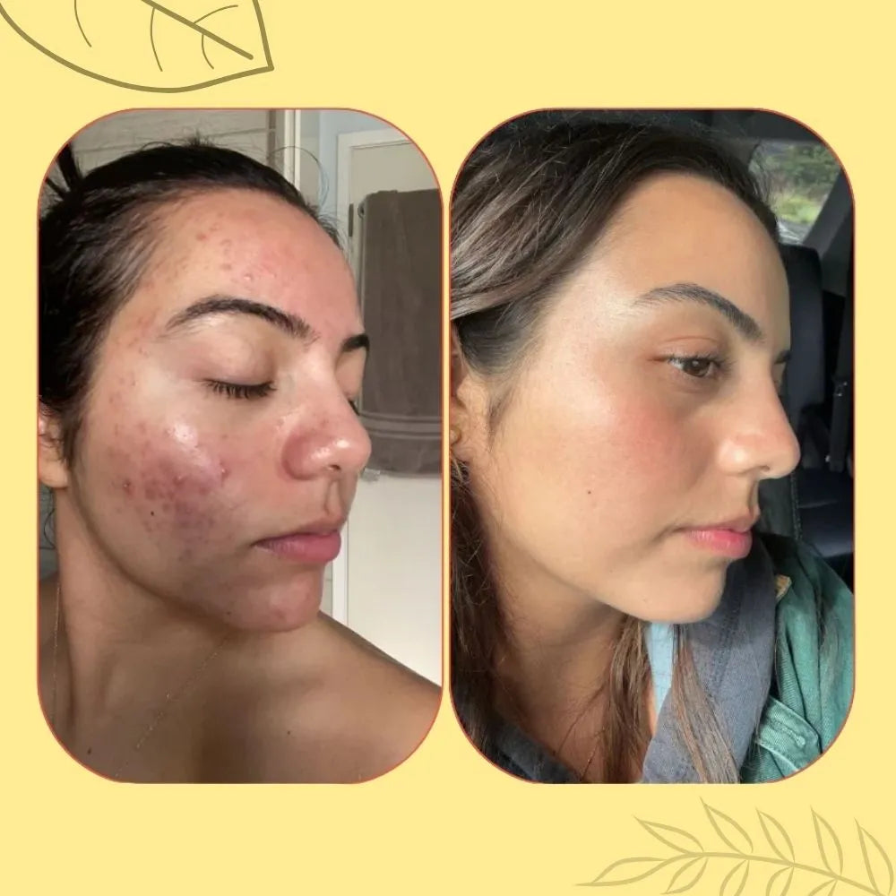 Sabonete Artesanal de Açafrão e Dolomita