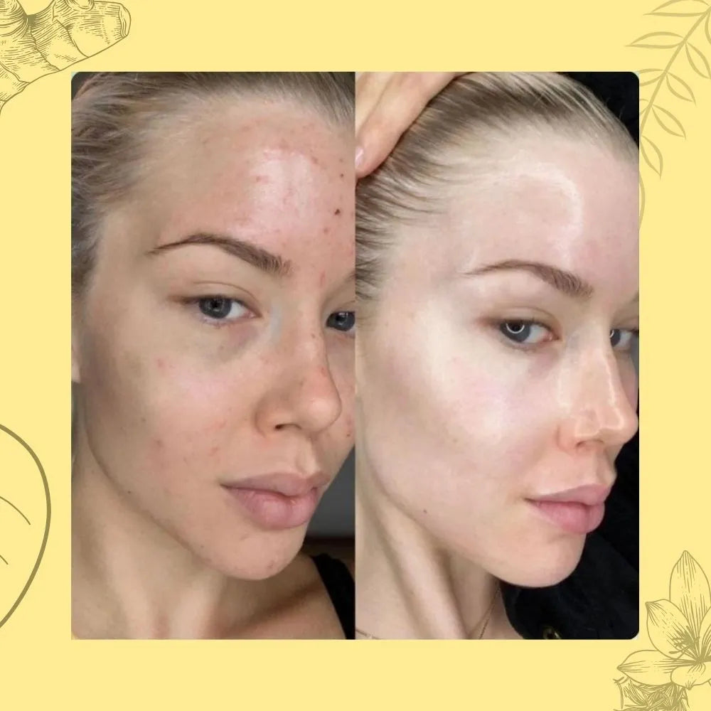 Sabonete Artesanal de Açafrão e Dolomita